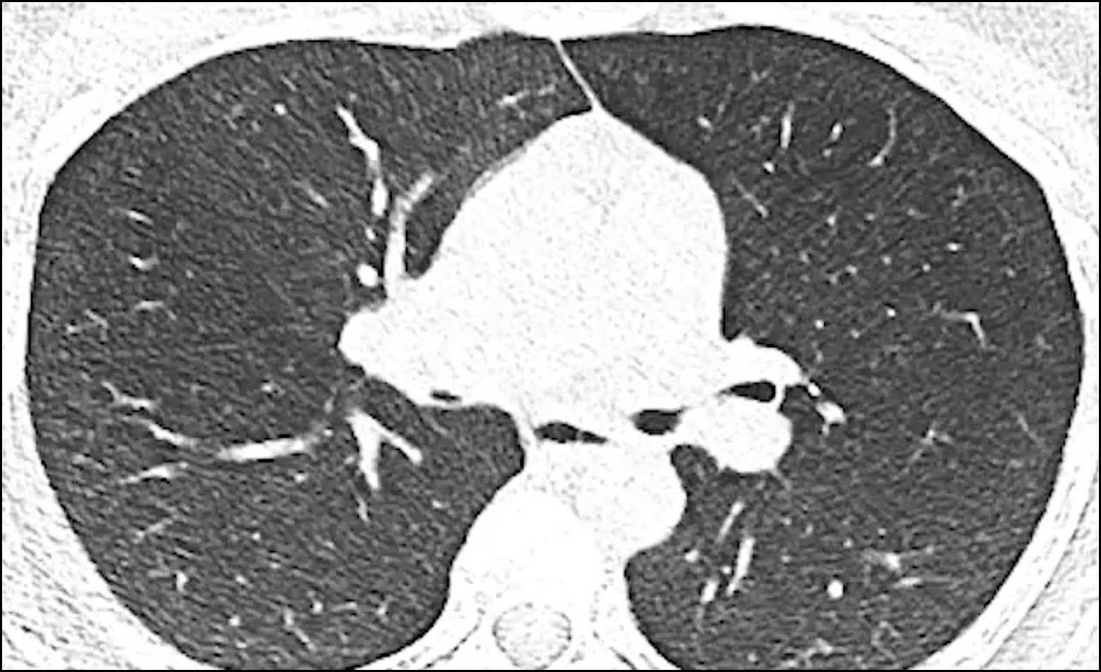 CT-Scan Expiration CT-Scan Expiration